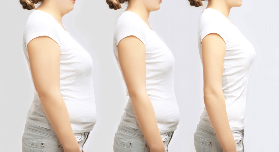 Hypnosis For Weight Loss